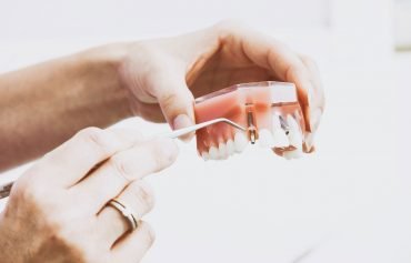 Dental Implants in Orlando, FL